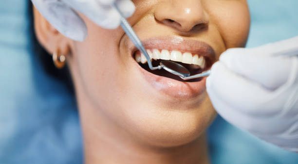 Best Emergency Root Canal Treatment in Ossian, IN