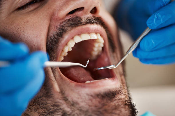 Best Emergency Treatment for Toothache in Ossian, IN